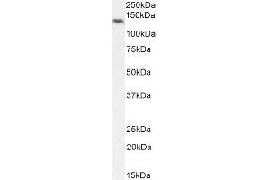 ABIN5539810 (2µg/ml) staining of Human Ovary lysate (35µg protein in RIPA buffer). (NLRP5 antibody  (C-Term))