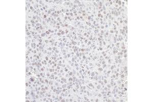Immunohistochemistry (IHC) image for anti-Guanine Nucleotide Binding Protein-Like 3 (Nucleolar) (GNL3) (C-Term) antibody (ABIN7453884)