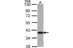 WB Image Sample (30 ug of whole cell lysate) A: JurKat 10% SDS PAGE antibody diluted at 1:1000 (LZTFL1 antibody)