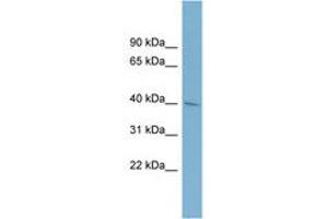 Image no. 1 for anti-alpha 1, 4-Galactosyltransferase (A4GALT) (AA 215-264) antibody (ABIN6742071) (A4GALT antibody  (AA 215-264))