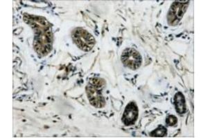 Immunohistochemistry (IHC) staining of Human Colon tissue, diluted at 1:200. (TUBB antibody)