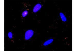 Proximity Ligation Analysis of protein-protein interactions between CAPN1 and F2R. (CAPNL1 antibody  (AA 1-714))