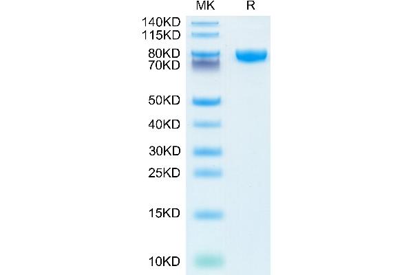 IL18RAP Protein (AA 20-356) (Fc Tag)