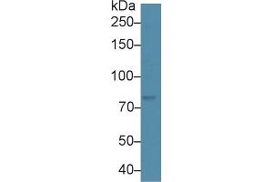 Detection of ADAMTS5 in Human Hela cell lysate using Polyclonal Antibody to A Disintegrin And Metalloproteinase With Thrombospondin 5 (ADAMTS5) (ADAMTS5 antibody  (AA 267-622))