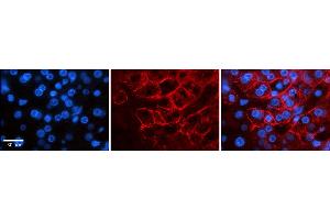 Rabbit Anti-SCN8A Antibody  Catalog Number: ARP35228_P050 Formalin Fixed Paraffin Embedded Tissue: Human Adult liver  Observed Staining: Membrane Primary Antibody Concentration: 1:100 Secondary Antibody: Donkey anti-Rabbit-Cy2/3 Secondary Antibody Concentration: 1:200 Magnification: 20X Exposure Time: 0. (SCN8A antibody  (C-Term))