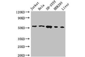 Western Blot Positive WB detected in: Jurkat whole cell lysate, Hela whole cell lysate, SH-SY5Y whole cell lysate, HEK293 whole cell lysate, Mouse liver tissue All lanes: FKBP8 antibody at 3 μg/mL Secondary Goat polyclonal to rabbit IgG at 1/50000 dilution Predicted band size: 45, 28 kDa Observed band size: 55 kDa (FKBP8 antibody  (AA 58-190))