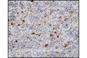 Immunohistochemistry (IHC) image for anti-Epstein-Barr Virus (EBV) (Internal Region) antibody (ABIN870466) (EBV antibody  (Internal Region))