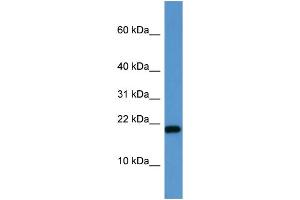 WB Suggested Anti-SH2D1A  Antibody Titration: 0.