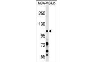 PIK3CB Antibody (N-term ) (ABIN652426 and ABIN2842105) western blot analysis in MDA-M cell line lysates (35 μg/lane). (PIK3CB antibody  (N-Term))