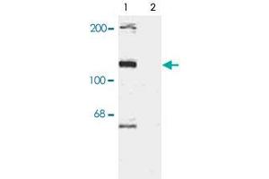 Western blot of rat cortex lysate showing specific immunolabeling of the ~120k Taok2 phosphorylated at Ser181 (Control).