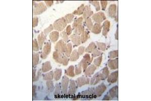 RUVBL1 (TIP49) Antibody (Center) (ABIN650670 and ABIN2850421) immunohistochemistry analysis in formalin fixed and paraffin embedded human skeletal muscle followed by peroxidase conjugation of the secondary antibody and DAB staining. (RUVBL1 antibody  (AA 247-280))