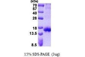 Figure annotation denotes ug of protein loaded and % gel used. (CTLA4 Protein)