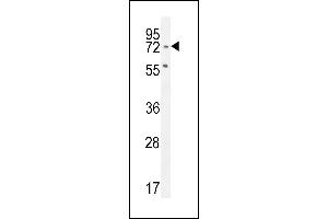 SLFN12L Antibody (N-term) (ABIN654871 and ABIN2844529) western blot analysis in Jurkat cell line lysates (35 μg/lane). (SLFN12L antibody  (N-Term))