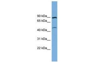 Image no. 1 for anti-Transmembrane Protein 48 (TMEM48) (AA 575-624) antibody (ABIN6744821) (TMEM48 antibody  (AA 575-624))