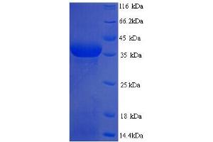 SDS-PAGE (SDS) image for Squamous Cell Carcinoma Antigen Recognized By T Cells 3 (SART3) (AA 600-900), (partial) protein (His tag) (ABIN5714352) (SART3 Protein (AA 600-900, partial) (His tag))