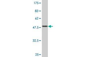 Western Blot detection against Immunogen (47. (Transgelin antibody  (AA 1-201))