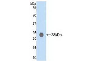 Detection of Recombinant NEP, Human using Polyclonal Antibody to Neprilysin (CD10) (MME antibody  (AA 565-750))