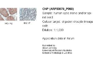 Immunohistochemistry with Brain, cortex tissue at an antibody concentration of 5µg/ml using anti-CNP antibody (ARP33879_P050) (Cnpase antibody  (Middle Region))