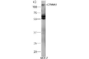 Human MCF-7 lysates probed with Rabbit Anti-Alpha Catenin/CTNNA1 Polyclonal Antibody, Unconjugated (ABIN731813) at 1:300 overnight at 4˚C. (CTNNA1 antibody  (AA 801-906))