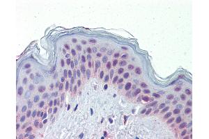 NR2C1 antibody  (N-Term)