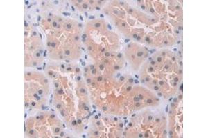 Immunohistochemistry (IHC) image for anti-Nucleophosmin (Nucleolar phosphoprotein B23, Numatrin) (NPM1) (AA 204-290) antibody (ABIN1860041)