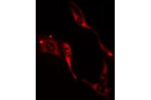 ABIN6274205 staining HuvEc cells by IF/ICC.