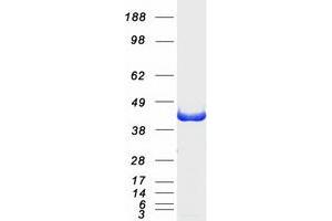 Western Blotting (WB) image for Deoxyhypusine Synthase (DHPS) (Transcript Variant 1) protein (Myc-DYKDDDDK Tag) (ABIN2719395)
