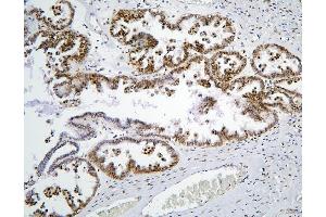 IHC analysis of PHF21A using anti-PHF21A antibody (ABIN6719353). (PHF21A antibody  (AA 1-97))