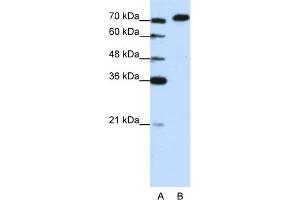 WB Suggested Anti-AKAP8L Antibody Titration:  1.