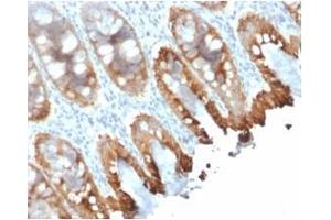 Formalin-fixed, paraffin-embedded human colon stained with Cytokeratin 8/18 Mouse Recombinant Monoclonal Antibody (rKRT8. (Recombinant KRT8, KRT18 antibody)