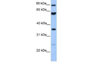 CCDC7 antibody used at 1 ug/ml to detect target protein. (CCDC7 antibody  (N-Term))