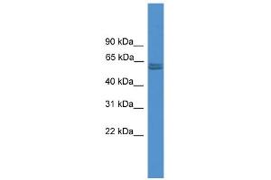WB Suggested Anti-PKM2 Antibody Titration: 0. (PKM2 antibody  (N-Term))
