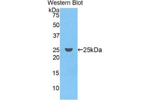 Western Blotting (WB) image for anti-Coagulation Factor IX (F9) (AA 61-263) antibody (ABIN1858770) (Coagulation Factor IX antibody  (AA 61-263))