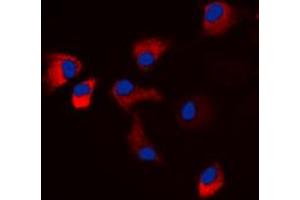 Immunofluorescent analysis of CaMK2 alpha/delta (pT286) staining in HeLa cells. (CaMK2 alpha/delta antibody  (pSer286))
