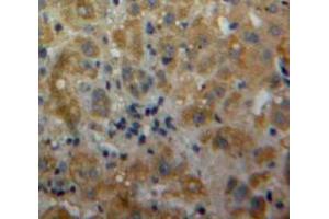 Used in DAB staining on fromalin fixed paraffin-embedded Liver tissue (IL-17 antibody  (AA 20-155))