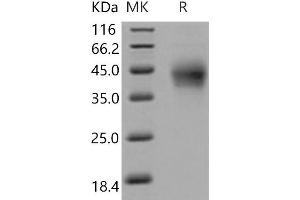 Western Blotting (WB) image for Programmed Cell Death 1 (PDCD1) protein (His tag) (ABIN7197475)