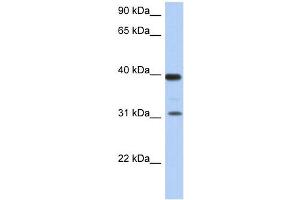 RPSA antibody used at 1 ug/ml to detect target protein. (RPSA/Laminin Receptor antibody  (Middle Region))