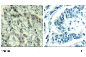 Image no. 1 for anti-Aurora Kinase A (AURKA) (pThr288) antibody (ABIN319282) (Aurora A antibody  (pThr288))