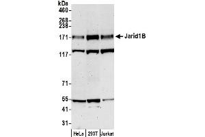 Western Blotting (WB) image for anti-Lysine (K)-Specific Demethylase 5B (KDM5B) (AA 1494-1544) antibody (ABIN7454788)