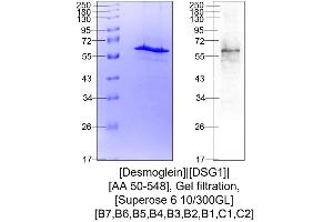 Western Blotting (WB) image for Desmoglein 1 (DSG1) (AA 50-548) protein (His tag) (ABIN3079162) (Desmoglein 1 Protein (DSG1) (AA 50-548) (His tag))