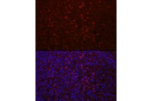 Immunofluorescence analysis of human spleen using CD4 Rabbit pAb (ABIN6134777, ABIN6138187, ABIN6138189 and ABIN6213821) at dilution of 1:100 (40x lens). (CD4 antibody  (AA 300-400))