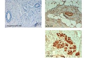 Immunohistochemistry of Rabbit anti ABCB5 antibody. (ABCB5 antibody  (Internal Region))