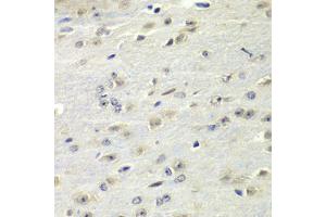 Immunohistochemistry of paraffin-embedded mouse brain using FMR1 Antibody (ABIN5973291) at dilution of 1/100 (40x lens).