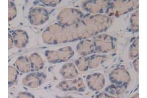 Immunohistochemistry (IHC) image for anti-Pregnancy Zone Protein (PZP) (AA 1224-1495) antibody (ABIN7438847)