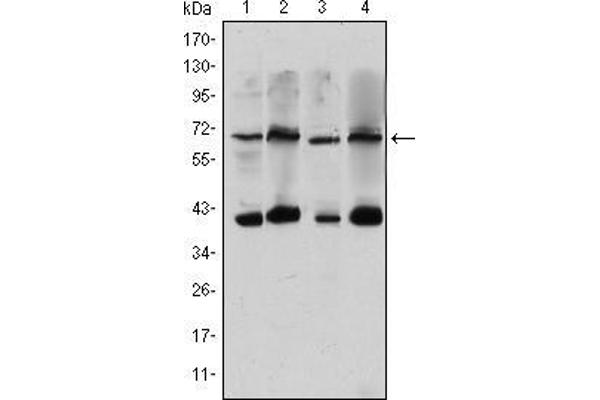 CRTC3 anticorps