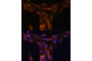 Immunohistochemistry (IHC) image for anti-Caspase 9, Apoptosis-Related Cysteine Peptidase (CASP9) (AA 1-98) antibody (ABIN6137975)