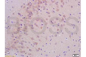 Formalin-fixed and paraffin embedded rat brain labeled with Anti-PHOSPHO-LLGL1 + LLGL2(SER650+SER654) Antibody, Unconjugated (ABIN761981) at 1:200 followed by conjugation to the secondary antibody and DAB staining (LLGL1 + LLGL2 (pSer650), (pSer654) antibody)