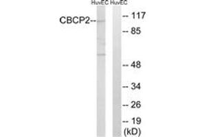Western blot analysis of extracts from HuvEc cells, using CBCP2 Antibody. (AGBL2 antibody  (AA 731-780))
