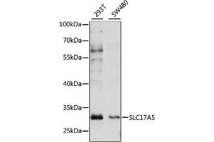 Western Blotting (WB) image for anti-Solute Carrier Family 17 (Acidic Sugar Transporter), Member 5 (SLC17A5) (AA 1-100) antibody (ABIN7270404)