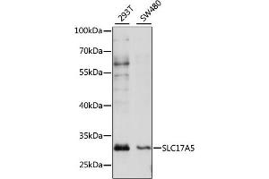 Western blot analysis of extracts of various cell lines, using SLC17 antibody (ABIN7270404) at 1:1000 dilution. (Solute Carrier Family 17 (Acidic Sugar Transporter), Member 5 (SLC17A5) (AA 1-100) antibody)